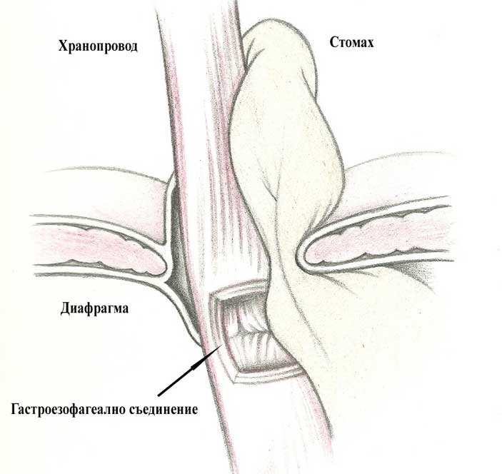 Д-р Теодор Атанасов Лапароскопска хирургия
